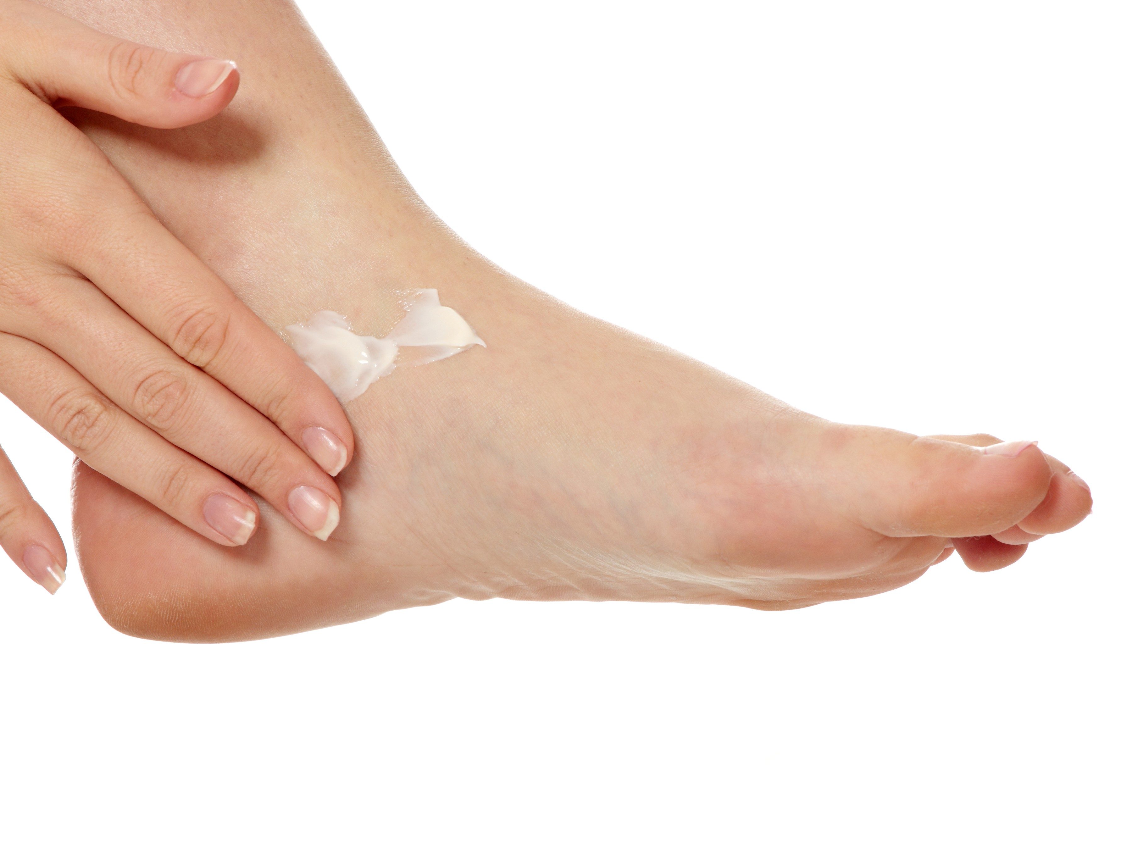 hydrocortisone cream for cracked feet