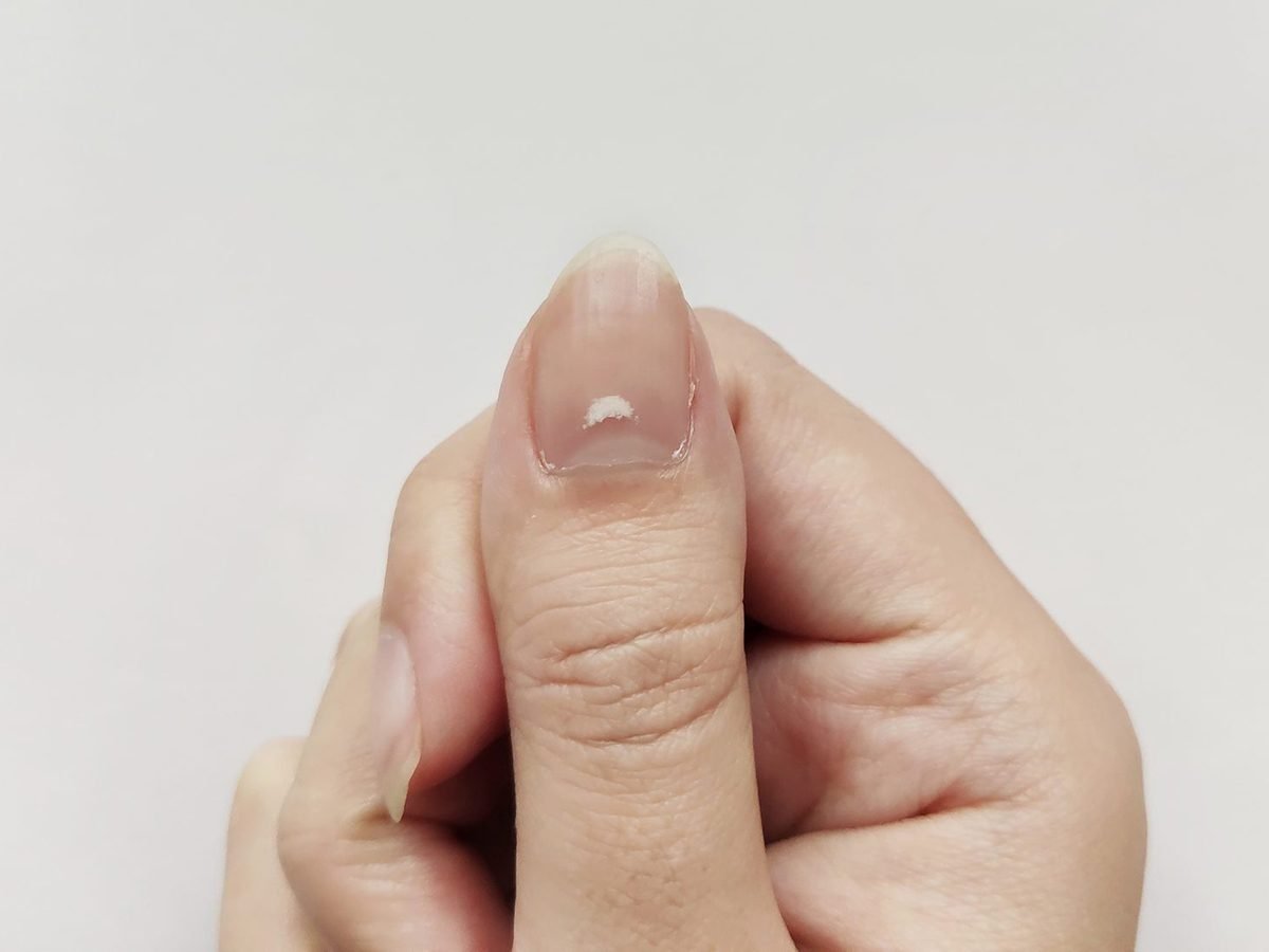 Here s What The White Spots On Your Nails Mean Reader s Digest