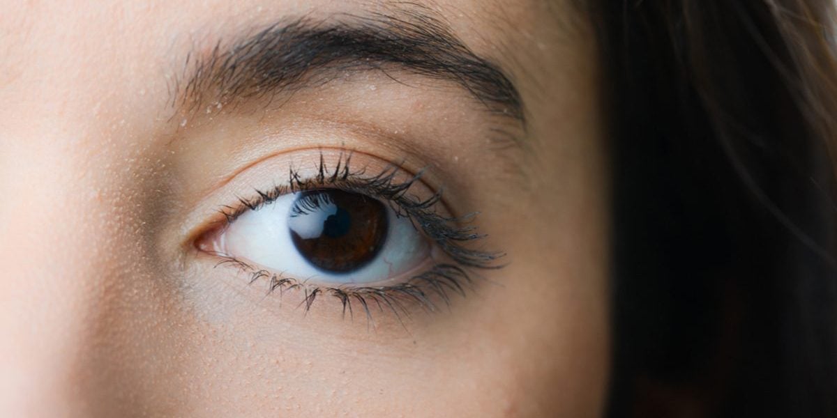 What Was Causing This Woman's Vision Loss? | Reader's Digest Canada