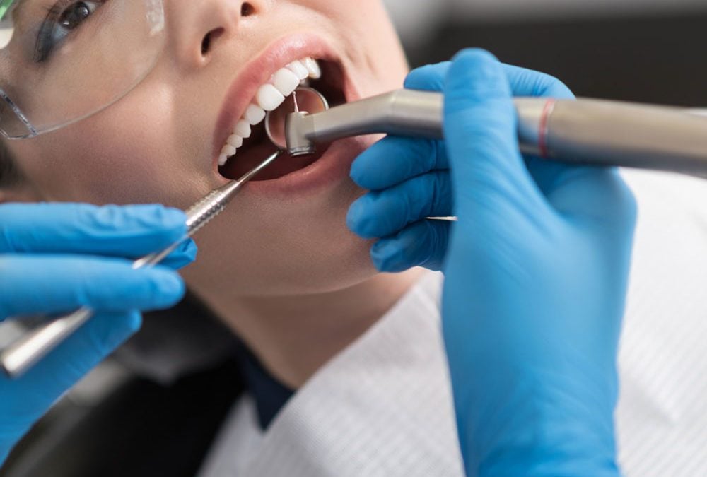 How Much Is A Teeth Cleaning No Insurance - TeethWalls